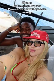 Virginia faz 31 aplicações de botox na cabeça; médica explica procedimento