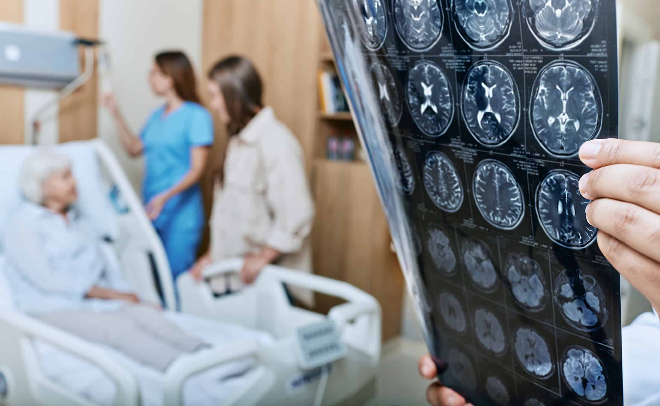 OMS atualiza recomendações para prevenir a demência; veja o que muda
