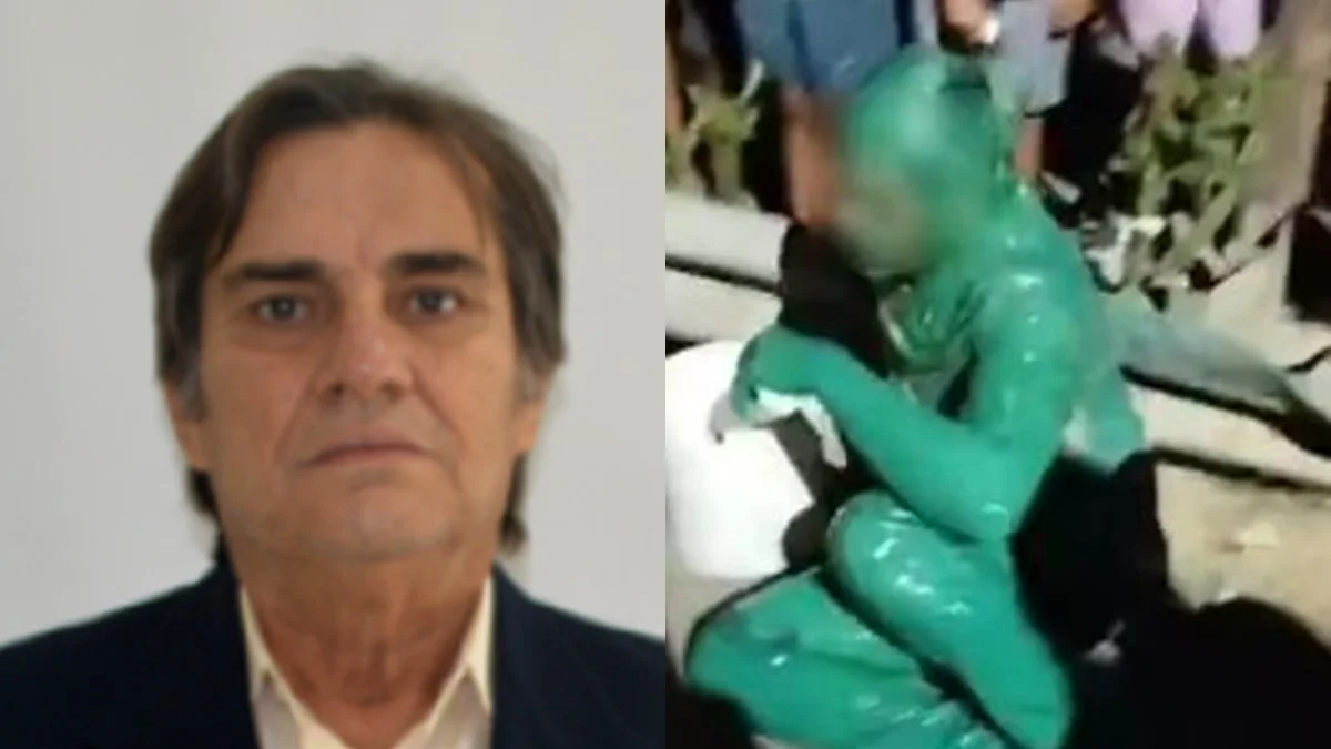 Morre vereador após acidente que deixou "homem pintado de verde" no Ceará